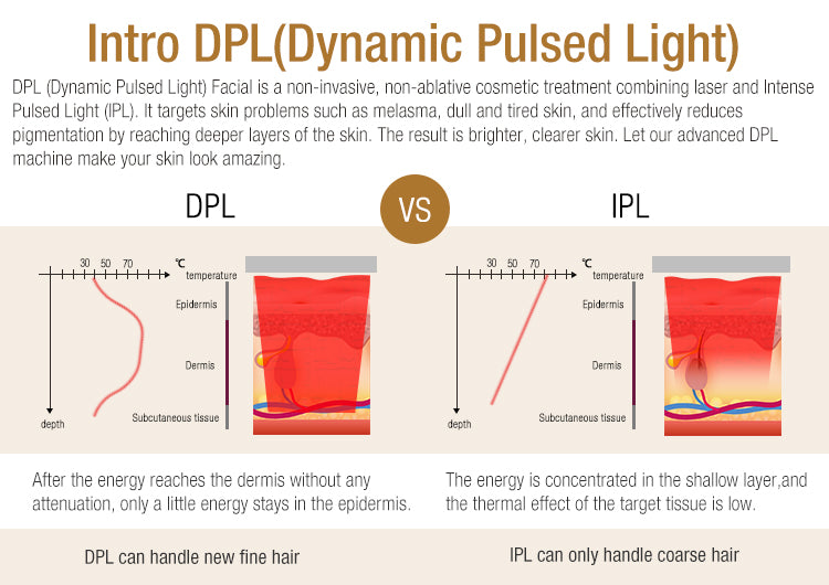 DPL technology