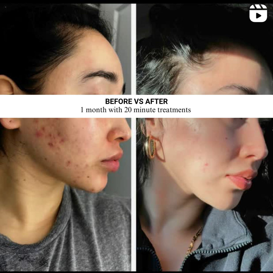 30-day free trial