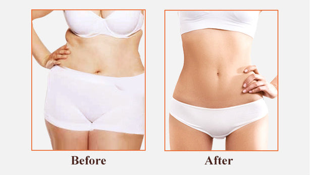 Winkonlaser DimaSlim HUR50 Cavitation Body Sculpting Machine