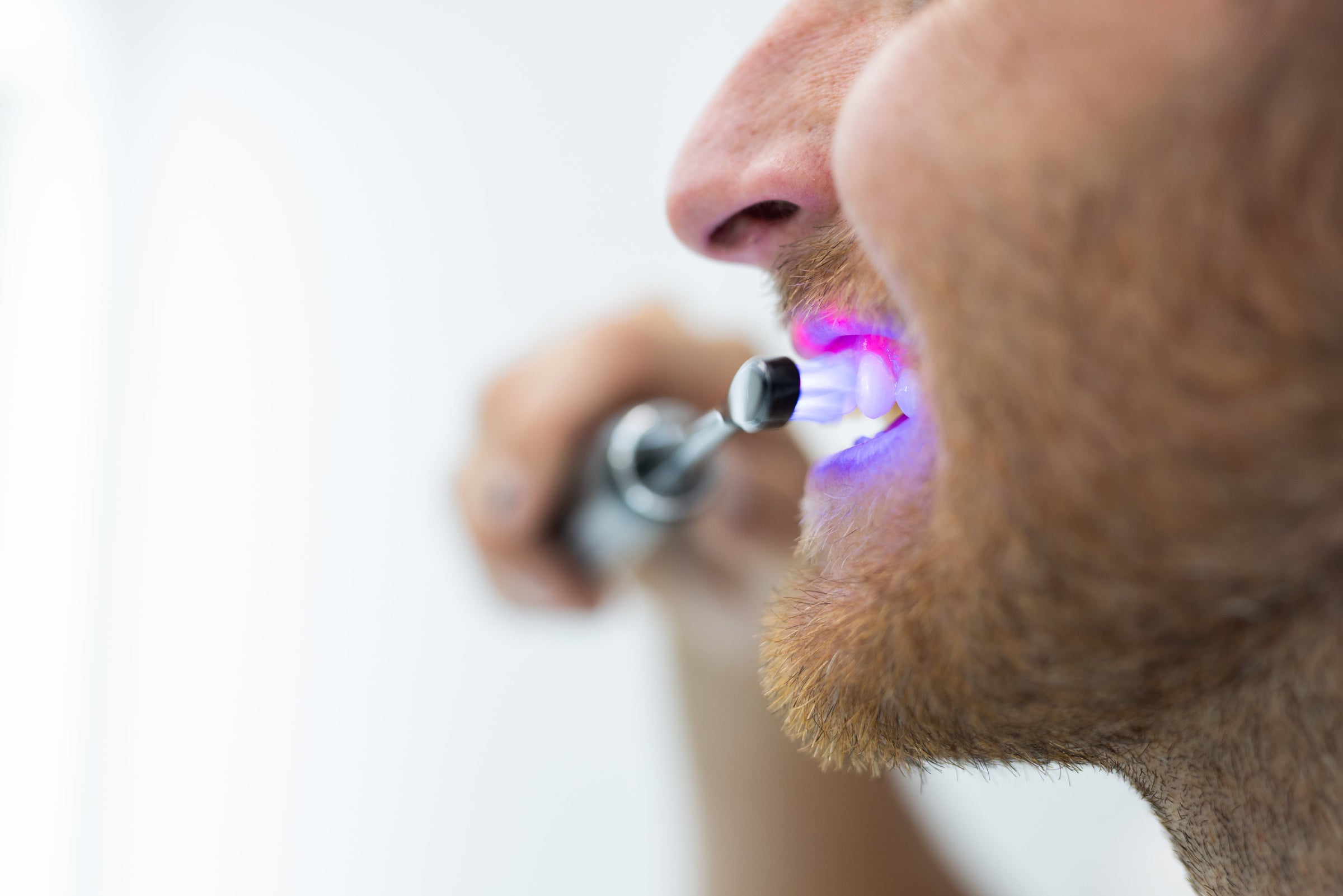 BioLight Illume Sonic Red and Blue Light Therapy Toothbrush