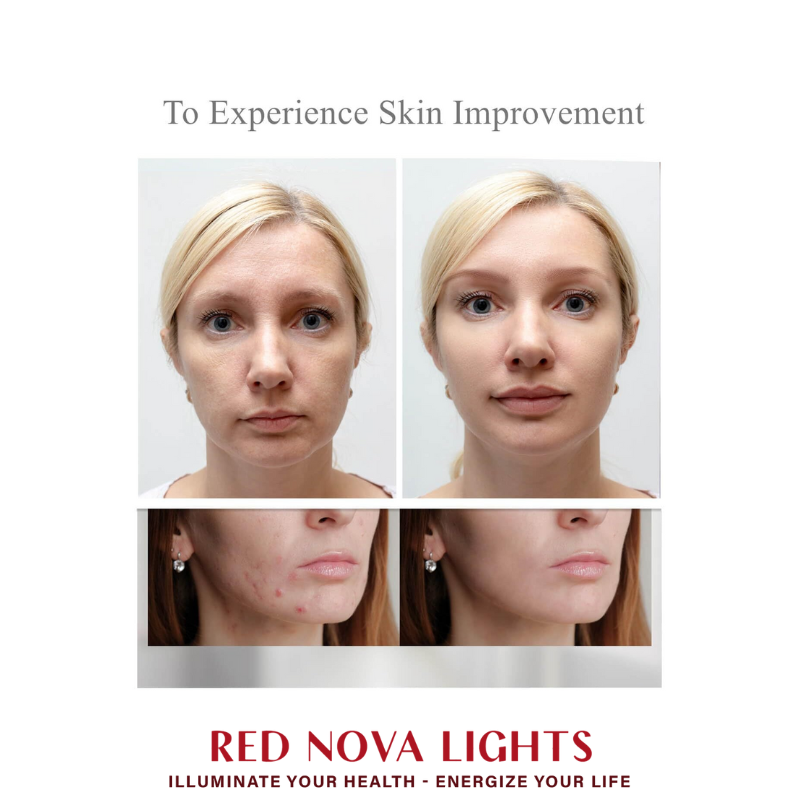 Red Nova Lights LED Red Light Therapy Face Mask
