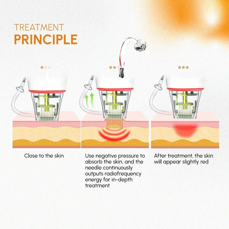 Shape Tactics 3-in-1 Targeted RF Microneedling System