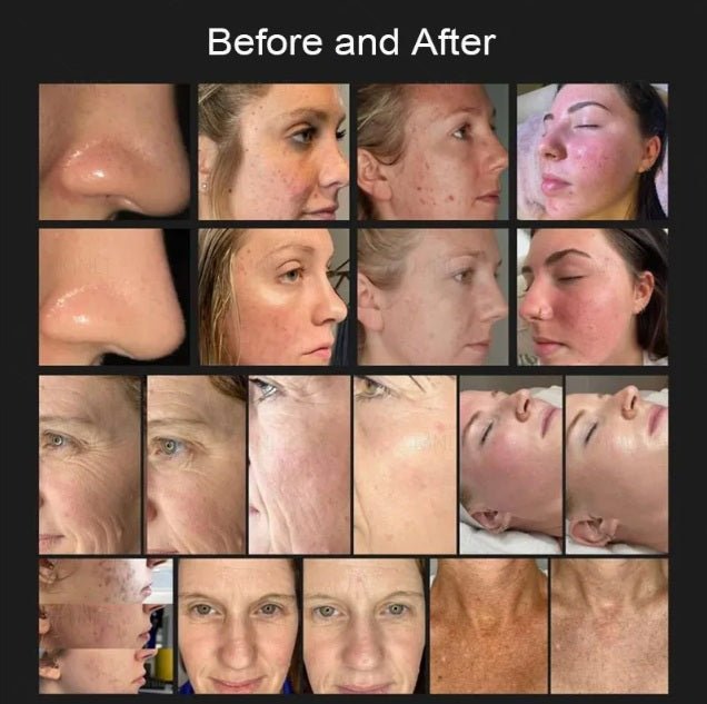 Shape Tactics 8-in-1 Hot and Cold Fusion Plasma Facial System