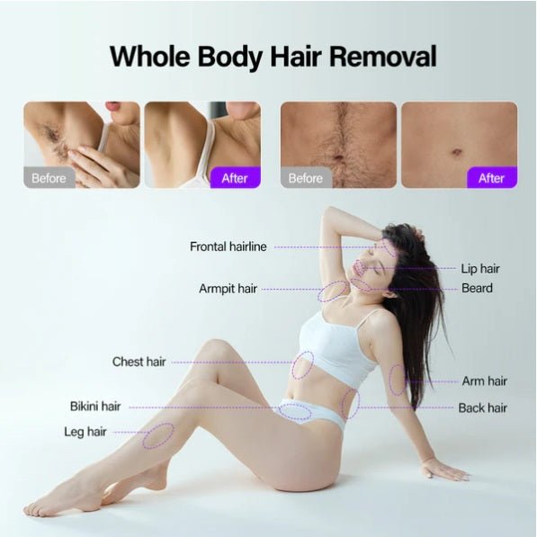 Shape Tactics Soprano Ice Pro 4-in-1 Laser Hair and Skin System